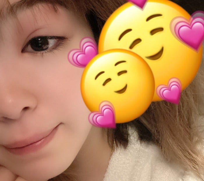 帰国の藤田ニコル 目が腫れた衝撃の自撮りショットを公開「にこるんの大事な顔が」