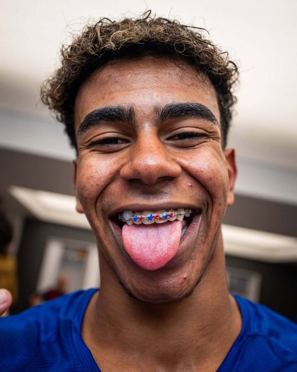 FCバルサ・ヤマル　クールすぎる歯列矯正器具を大公開！