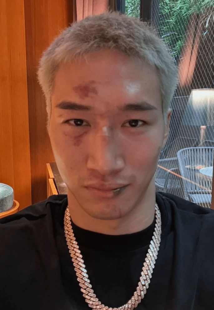 ブレイキングダウンでも話題の総合格闘家、壮絶な殴り合い後の顔面を公開