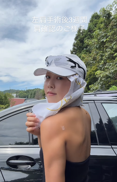 陣在ほのかが順調な肩の経過を報告！ギブスが取れた姿で傷跡の目立たない肩回りを披露！