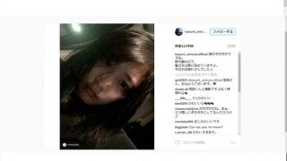 有村架純、脚が傷だらけに…「毎日サバイバルです」女優魂のぞかせる