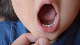 子どもの歯並びと身体の関係