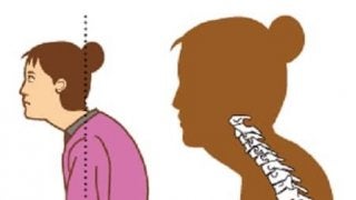 ストレートネックの原因とは