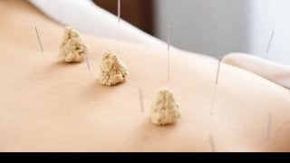 科学的に検証された「鍼灸治療」の効果とは？