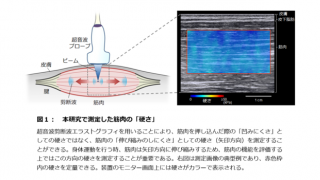 アスリートの筋肉の硬さが競技パフォーマンスに影響…順天堂