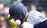顔面付近に死球受けた阿南光・井坂選手は打撲傷と診断　センバツ