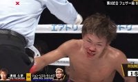 「止めろ危ない」「壊されてしまう」カシメロ、流血の衝撃TKO劇にファン戦慄 強打炸裂で「大丈夫か？」相手を気遣う余裕も